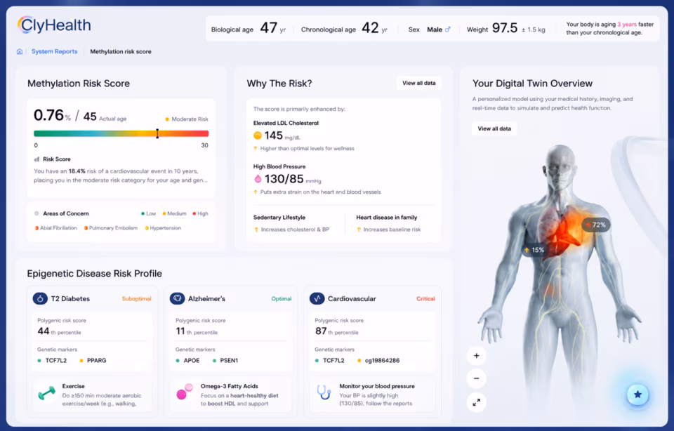 AI product design: the decisions made before the interface